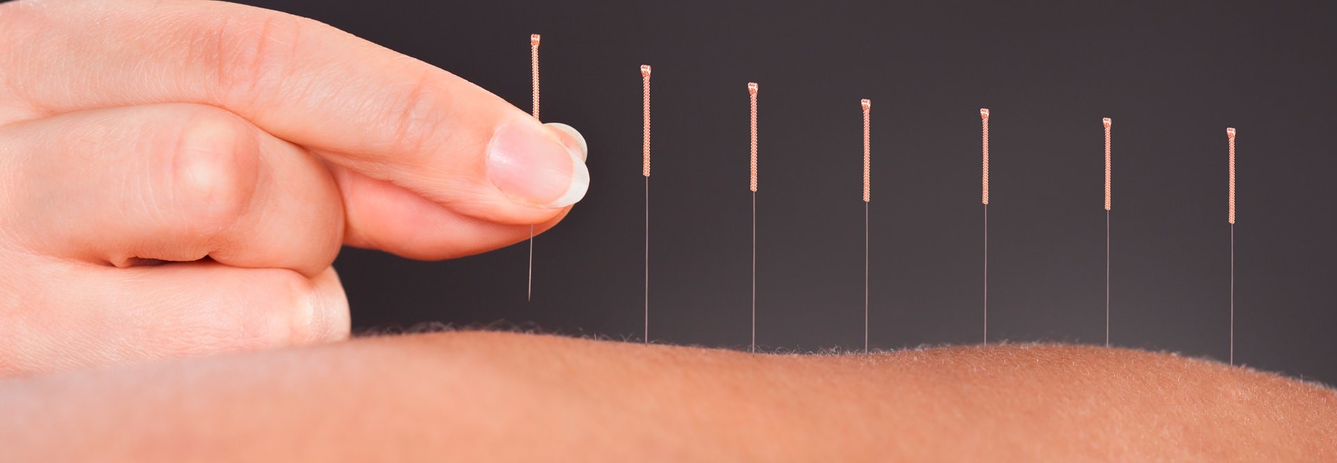 Dalez Bernard - Acupuncteur - Wazaa.be