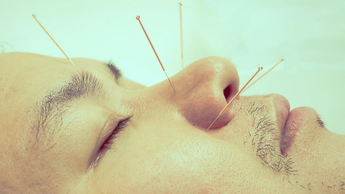 Acupuncture à Arlon - Wazaa