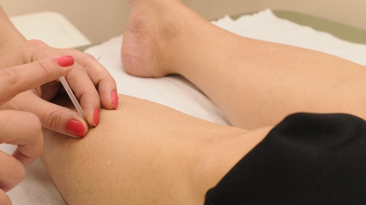 Acupuncture dans le Brabant wallon - Wazaa