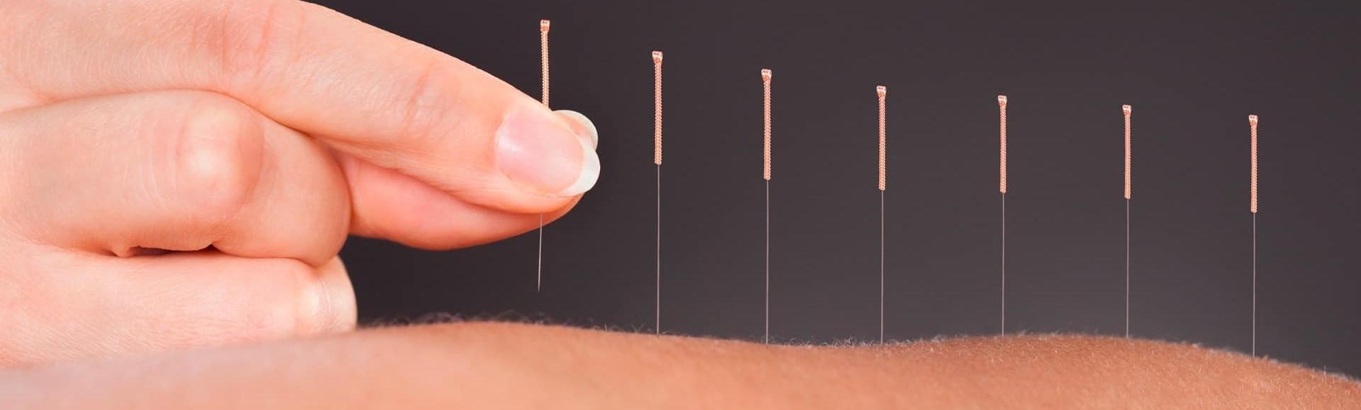 Verhulst Lea - zoek Acupuncturisten in Vlaanderen op Wazaa