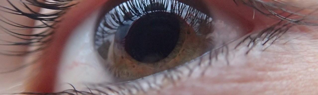 Brussels Eye Doctors - Ophtalmologue - Wazaa
